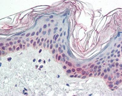 Anti-PARP2 (Internal) Antibody