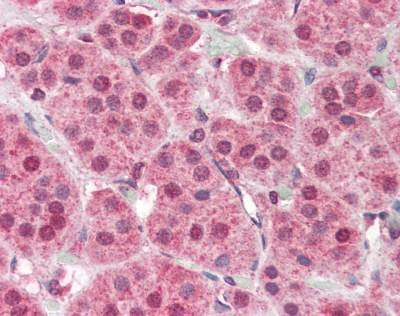 Anti-PARP2 (Internal) Antibody