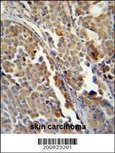 Anti-ALDH3A2 (Ascites) Antibody