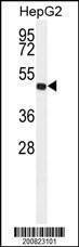 Anti-ALDH3A2 (Ascites) Antibody
