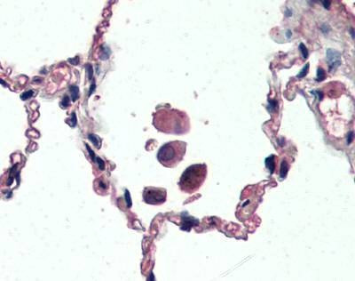 Anti-UCP2 (Internal) Antibody