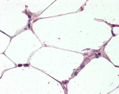 Anti-UCP2 (Internal) Antibody