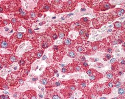 Anti-Cathepsin D Antibody