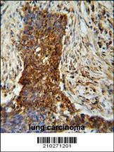 Anti-MMP2 (Ascites) Antibody