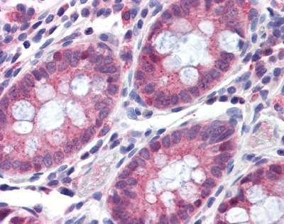 Anti-TMPRSS4 (Internal) Antibody