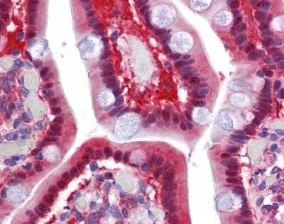 Anti-TMPRSS4 (Internal) Antibody