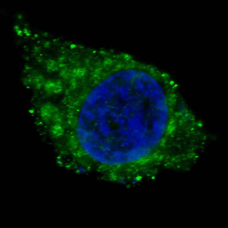 Anti-ALDH1A1 Antibody