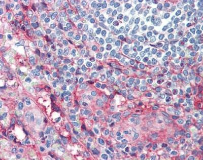 Anti-ICAM-1 / CD54 Antibody