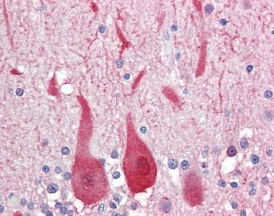 Anti-Aldolase 3 / ALDOC (C-term) Antibody