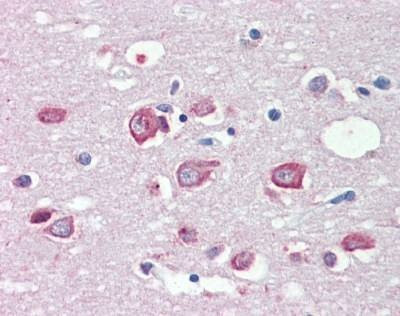 Anti-MLL4 (C-term) Antibody