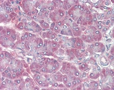 Anti-CRBP1 / CRBP (C-term) Antibody