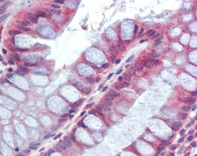 Anti-FIZZ1 / RELM-Beta (Internal) Antibody