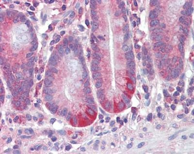 Anti-FIZZ1 / RELM-Beta (Internal) Antibody