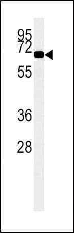 Anti-ACOX1 Antibody