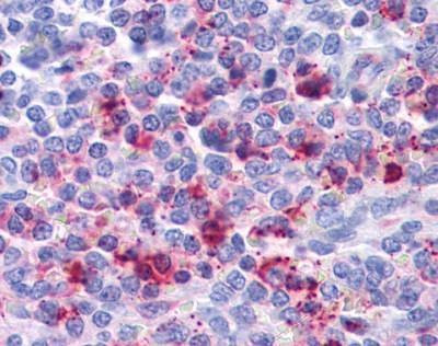 Anti-CXCR2 (N-term) Antibody