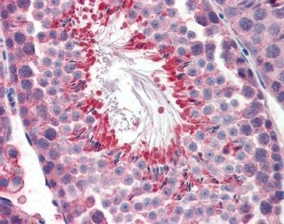 Anti-Mouse TIP47 (Internal) Antibody