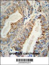 Anti-AKT2 Antibody