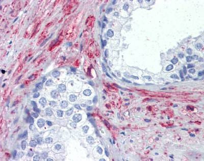 Anti-PRKG Antibody
