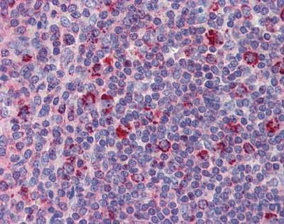 Anti-DAP12 Antibody
