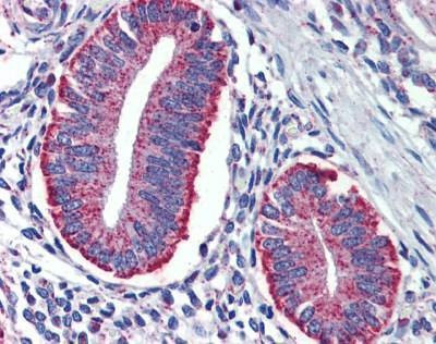 Anti-DAP12 Antibody