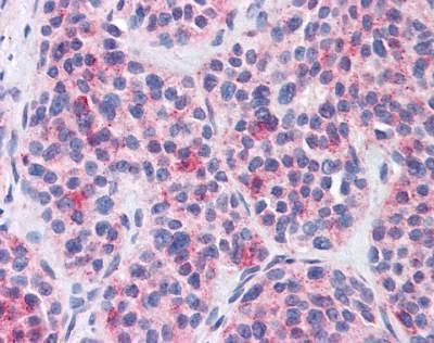 Anti-FKSG89 / MBOAT4 (Internal) Antibody