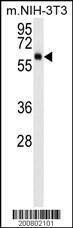 Anti-AKT3 Antibody
