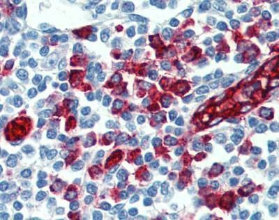 Anti-PSGL-1 / CD162 Antibody
