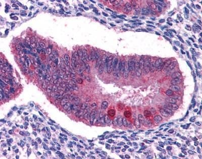 Anti-FKHRL1 / FOXO3A (C-term) Antibody
