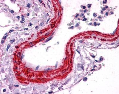 Anti-Smooth Muscle Actin (N-term) Antibody