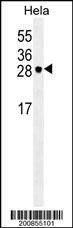 Anti-EIF4E Antibody