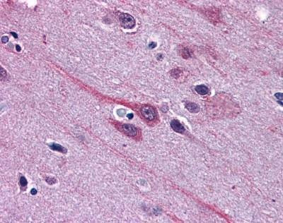Anti-GBX2 (Internal) Antibody