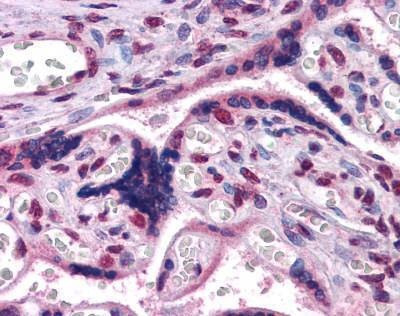 Anti-GBX2 (Internal) Antibody