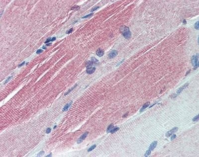 Anti-IGFBP6 (Internal) Antibody