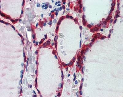 Anti-Peroxiredoxin 1 (Internal) Antibody