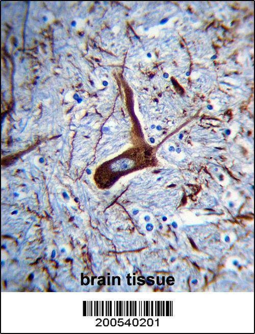 Anti-MAP2 (Ascites) Antibody
