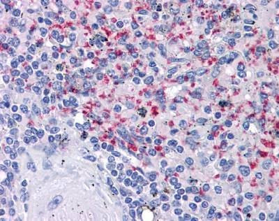 Anti-CD61 Antibody