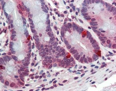 Anti-ARL2 Antibody