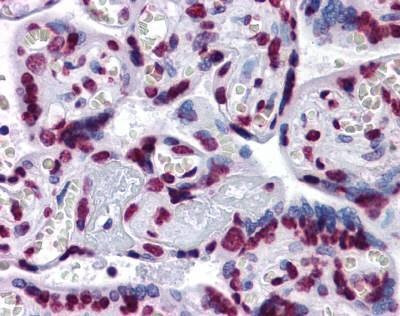 Anti-STAT3 Antibody