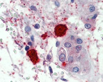 Anti-CMA1 / Chymase (Internal) Antibody