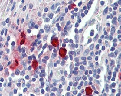 Anti-CMA1 / Chymase (Internal) Antibody