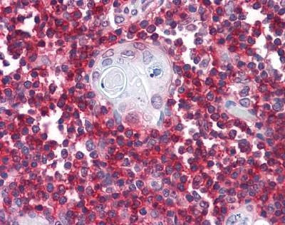 Anti-CD247 / CD3 Zeta Antibody