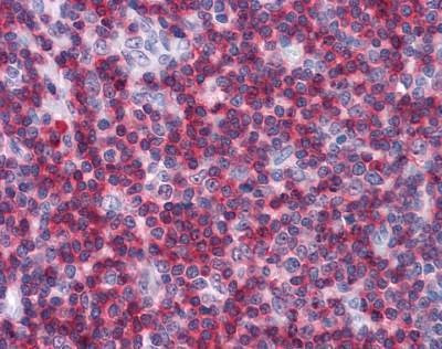 Anti-CD247 / CD3 Zeta Antibody