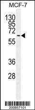 Anti-MAPK15 Antibody