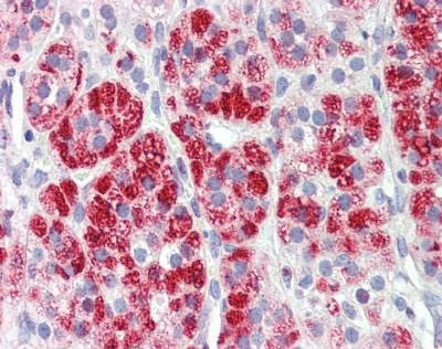 Anti-Clathrin Heavy Chain (Internal) Antibody