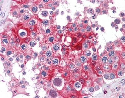 Anti-Lactate Dehydrogenase A Antibody