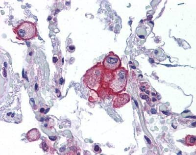 Anti-TRPV2 Antibody
