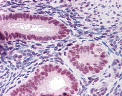 Anti-CBFA1 / RUNX2 Antibody