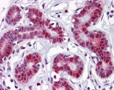 Anti-GILZ Antibody