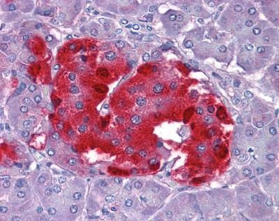 Anti-Chromogranin A (Internal) Antibody