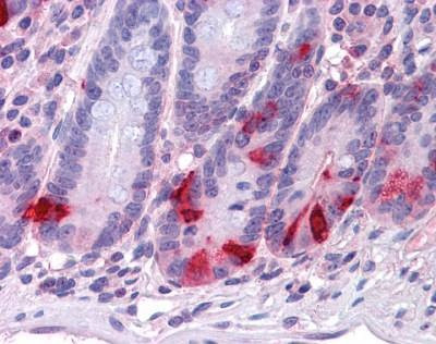Anti-Chromogranin A (Internal) Antibody
